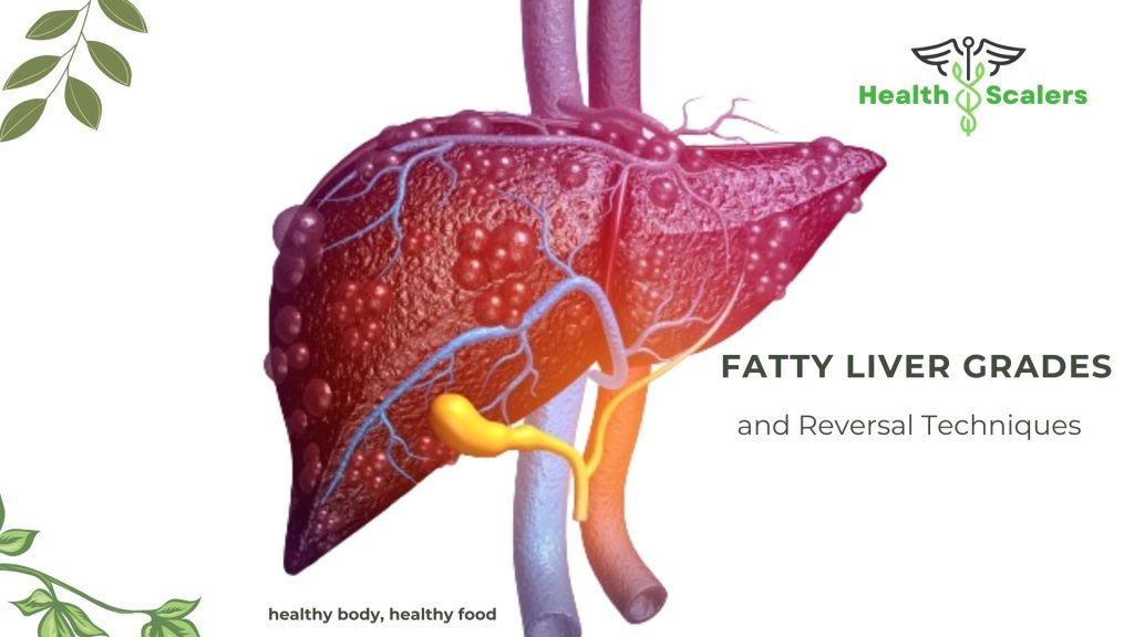 Fatty Liver Grades and Reversal Techniques