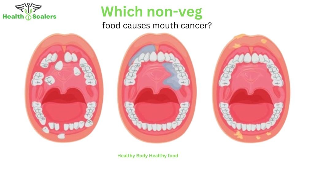 Which non-veg food causes mouth cancer?