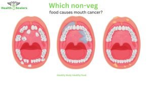 Which non-veg food causes mouth cancer?